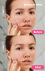 Neogen Dermalogy A Clear Soothing Clear Spot Patch