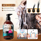 SADOER Anti-Hair Loss Shampoo | Deep Dandruff Removal &amp; Oil Control