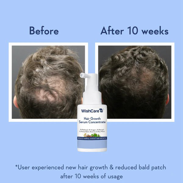 WishCare Hair Growth Serum